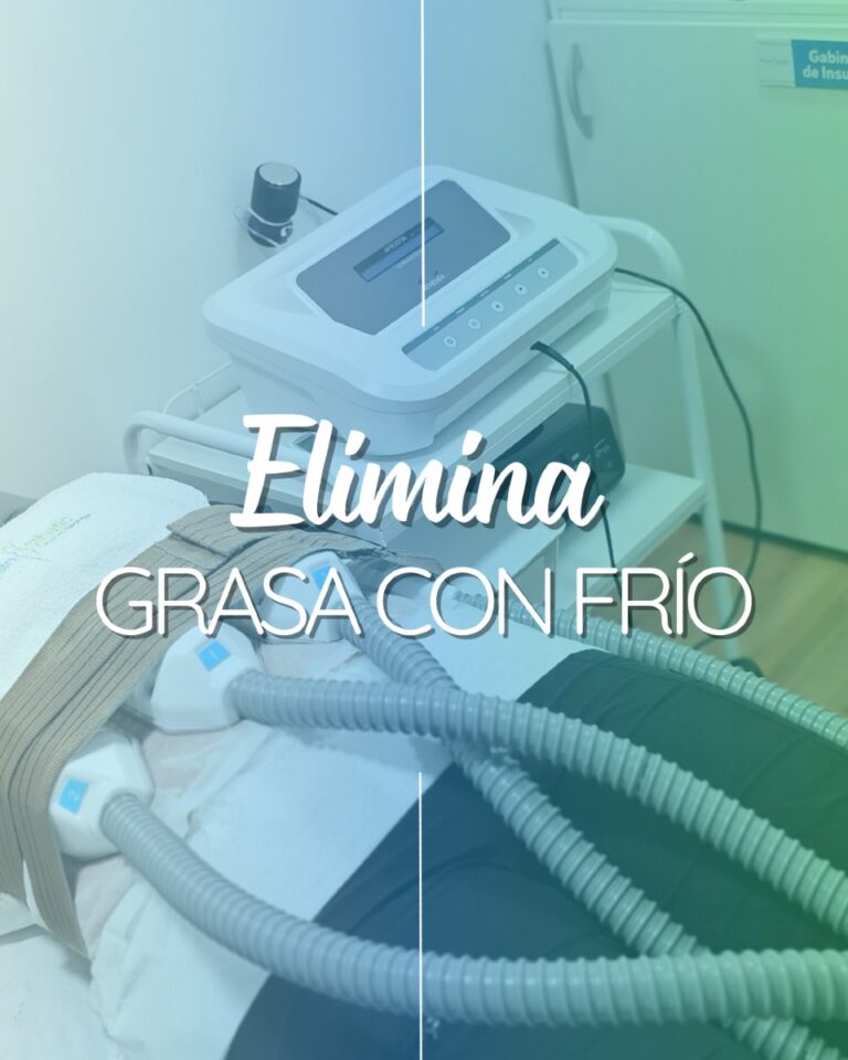 Instagram post from physiosthetic.contacto. This post is in position 9.