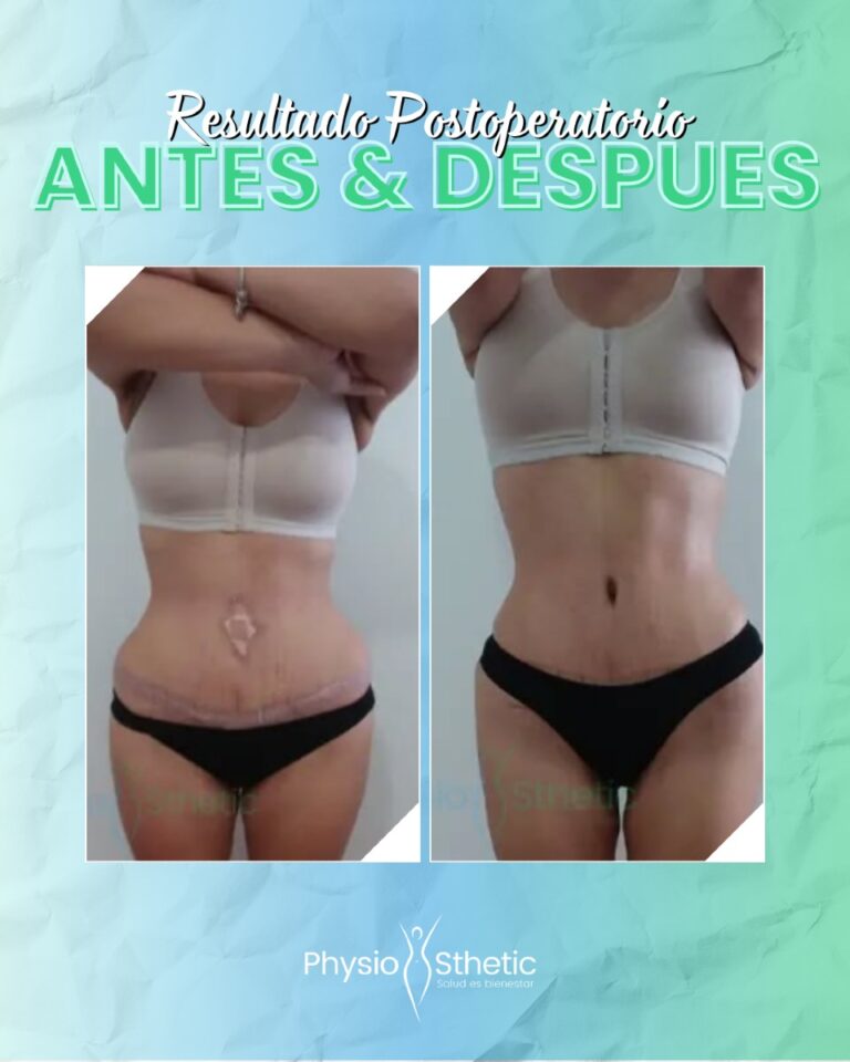 Instagram post from physiosthetic.contacto. This post is in position 5.